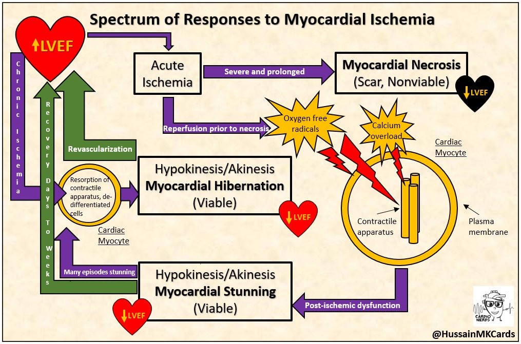 Nuclear and Multimodality Imaging: Cardiac Amyloidosis - CardioNerds